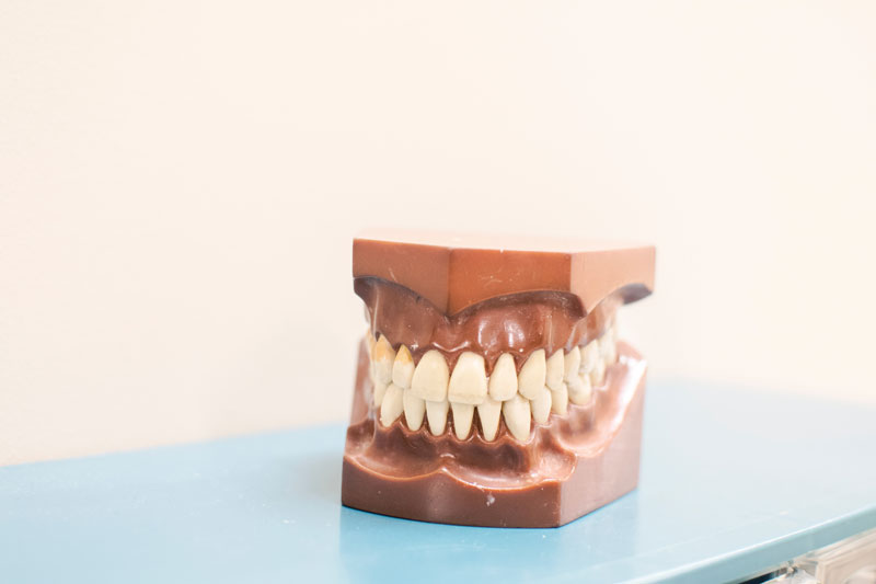 Detailed dental model used for precise treatment planning